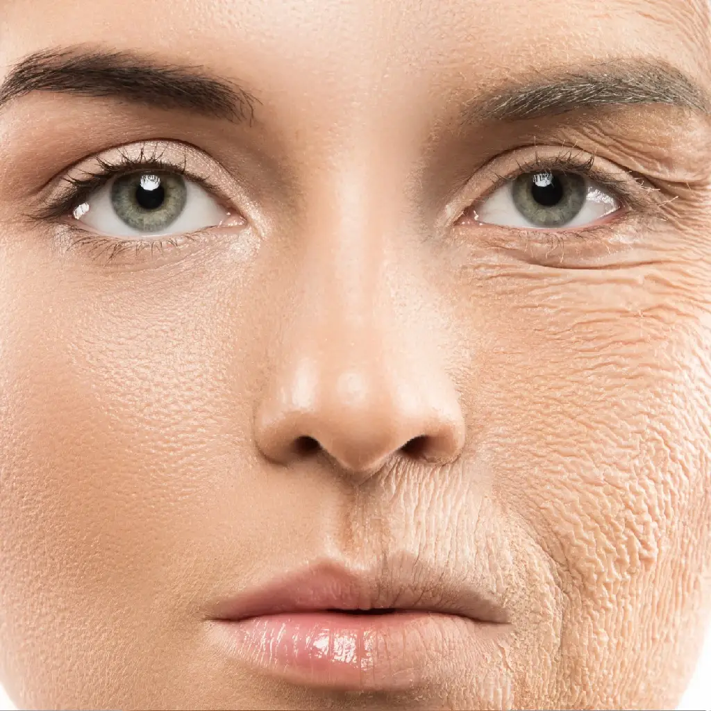 botox treatment in kanpur botox treatment in kanpur botox treatment in kanpur