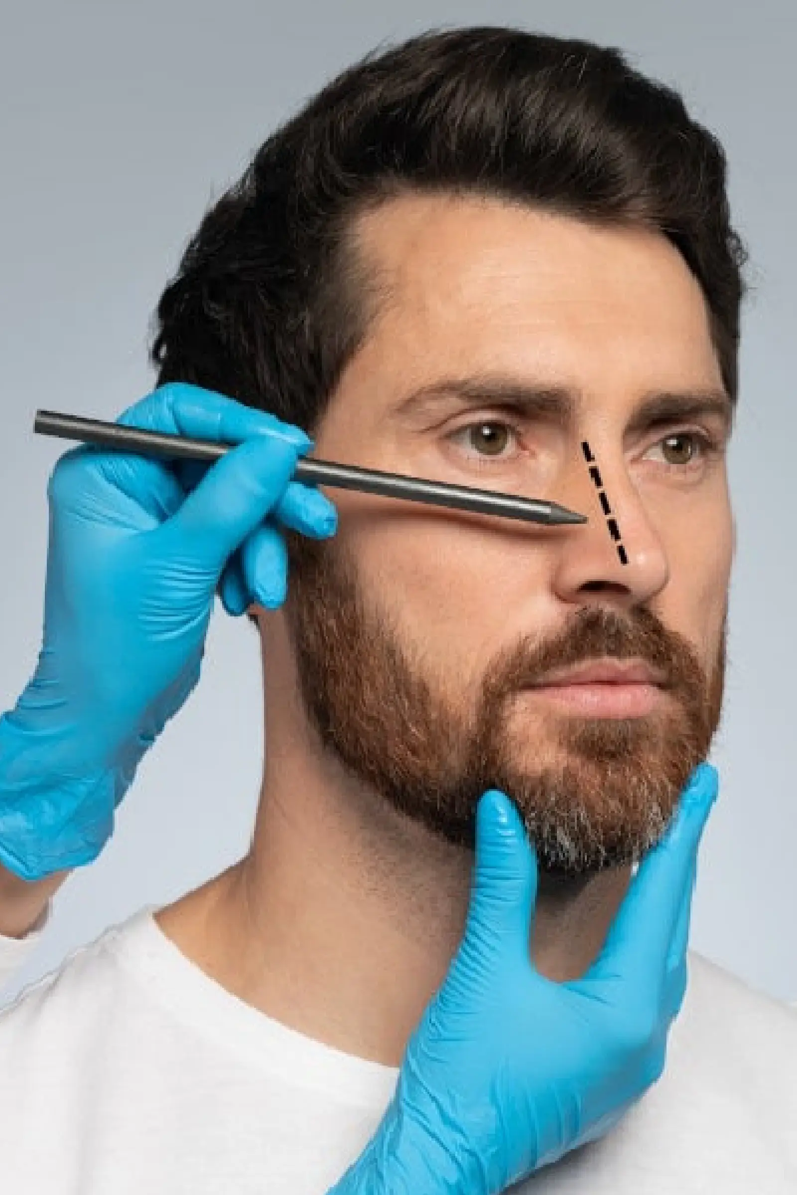 rinoplasty surgery in kanpur